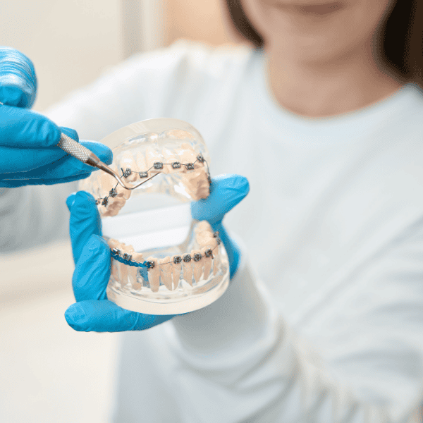 Teeth Replacement Image